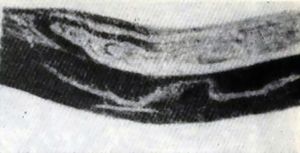 Деталь индийского булатного клинка из собрания Государственного Эрмитажа. Узор образован  прядями линий, меняющими изгиб и ширину