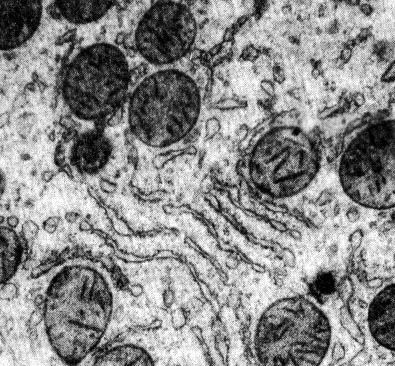 Нормальная печень. Фрагмент гепатоцита с митохондриями и участками гладкой цитоплазматической сети.